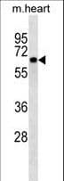 CNOT4 / CLONE243 Antibody