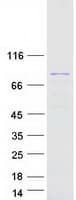Human LMOD3 Protein (Recombinant Myc-DDK (Flag))