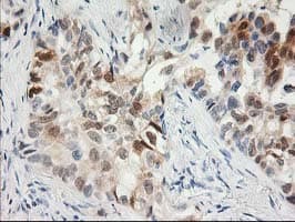 Monoclonal Mouse anti-Human 15-PGDH / HPGD Antibody (clone OTI2F5, IHC, WB)
