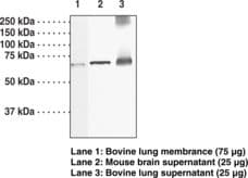 IHC-plus™ GUCY1B3 Antibody