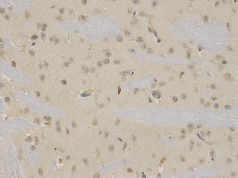 Polyclonal Rabbit anti-Human NR0B2 Antibody (IHC, IF, WB)