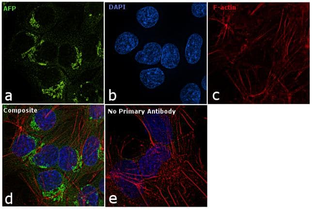 Alpha-Fetoprotein Antibody (clone AFP-01)