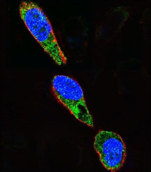 SRC Antibody (Tyr419)