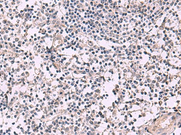 KCNIP1 / KCHIP1 Antibody