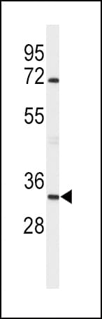 IHC-plus™ APOD / Apolipoprotein D Antibody (aa26-53)