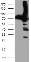 PFKP Antibody (clone OTI1F2)