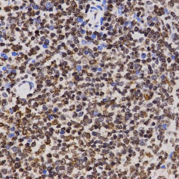 Histone H3 Antibody (Methyl-Lys4)