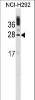 CIB1 / KIP Antibody (aa122-151)