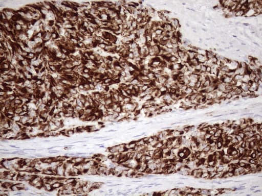 KRT18 / CK18 / Cytokeratin 18 Antibody (aa69-372, clone OTI3D1)