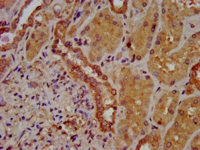 SLC26A6 / PAT1 Antibody