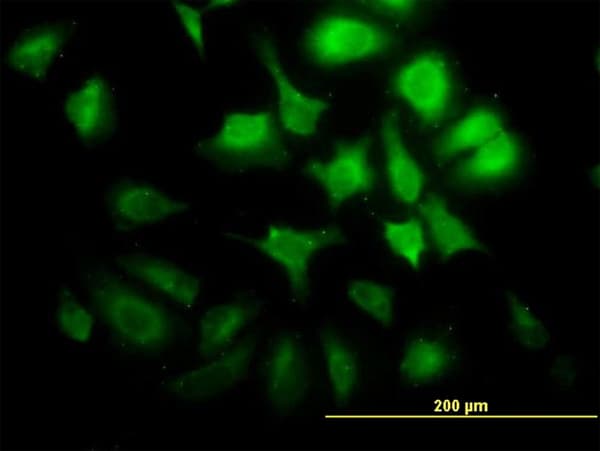 CCNG2 / Cyclin G2 Antibody (clone 1F9-C11)