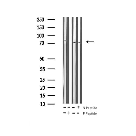 Polyclonal Rabbit anti-Human PTPN11 / SHP-2 / NS1 Antibody (phospho-Tyr542, IHC, IF, WB)