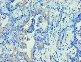 PRKAB2 / AMPK Beta 2 Antibody (aa1-272)