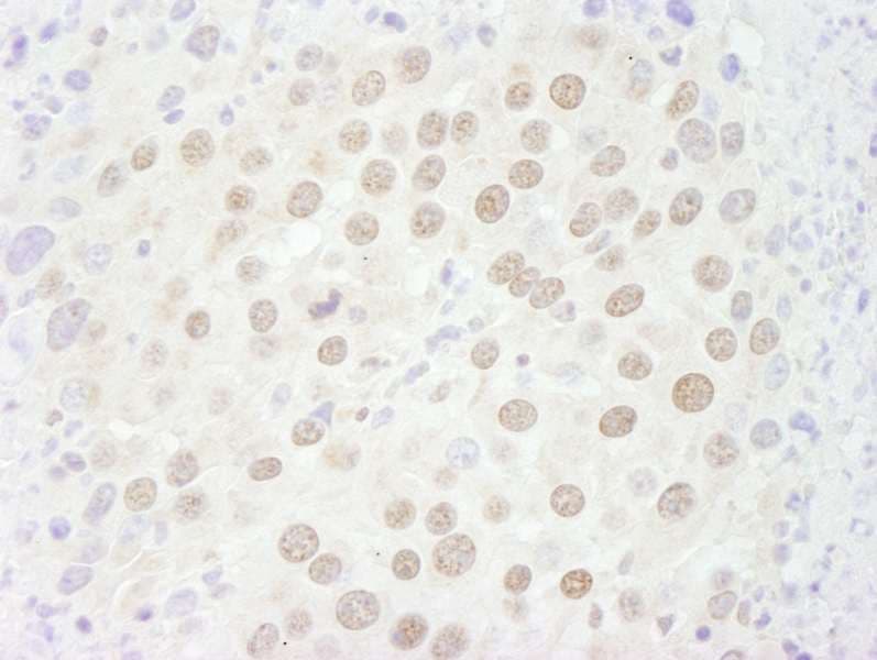 GATAD2B Antibody (aa50-100)