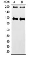 Polyclonal Rabbit anti-Human IGF1R / IGF1 Receptor Antibody (C-Terminus, IHC, WB)