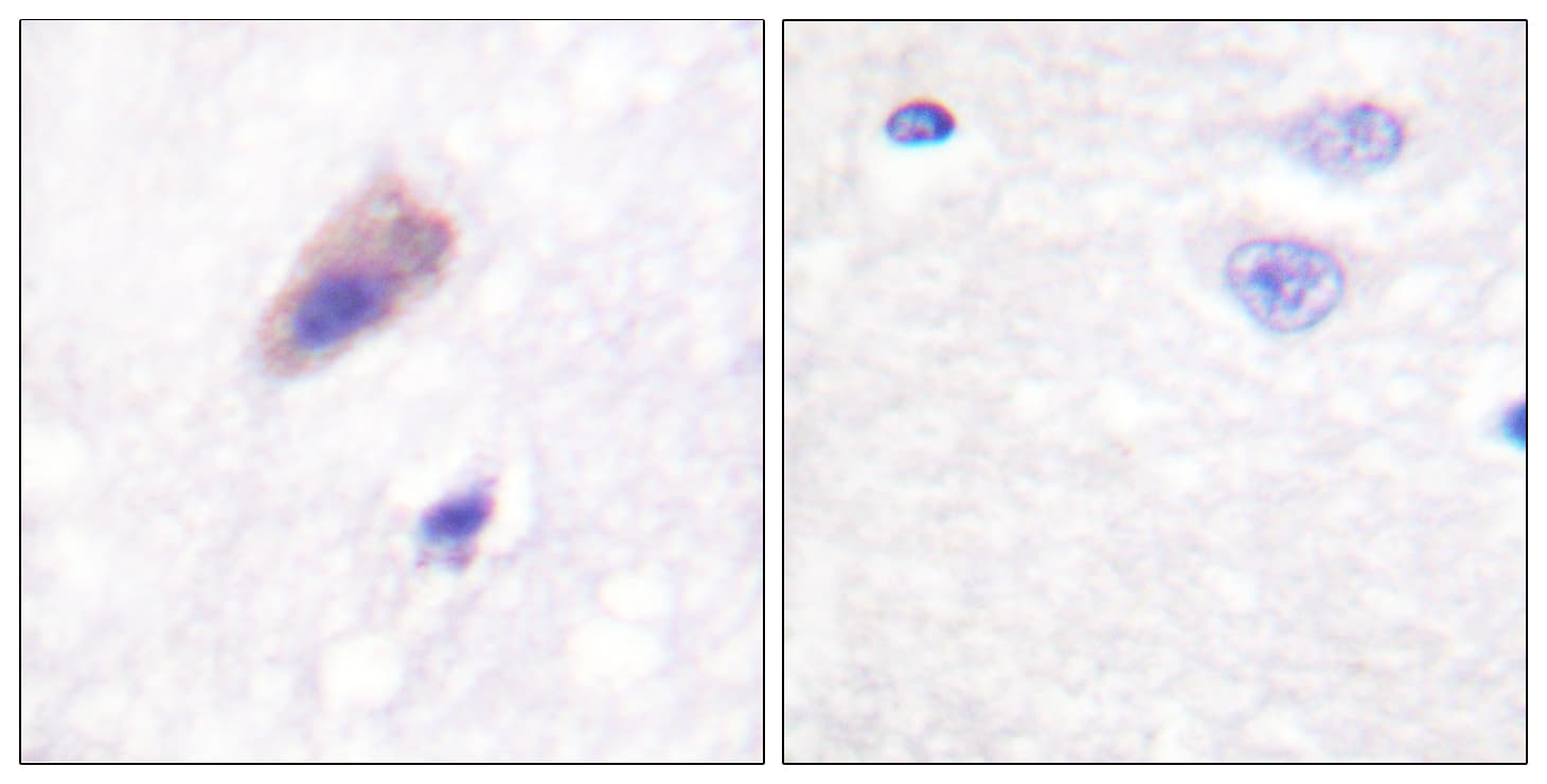 Polyclonal Rabbit anti-Human DNM1 / Dynamin Antibody (phospho-Ser774, IHC, WB)