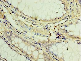 Trimethylguanosine Synthase 1 Antibody (aa714-853)