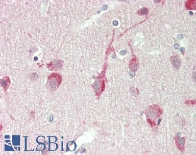 PSAT1 Antibody (aa99-148)