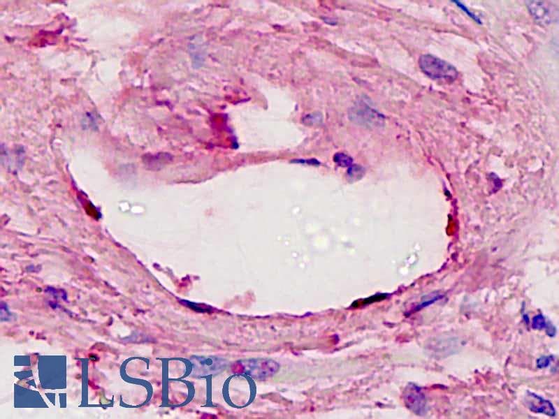 IHC-plus™ FLT4 / VEGFR3 Antibody