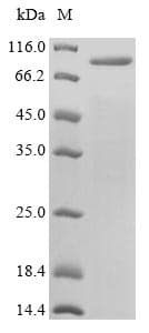 Varicella Zoster Virus (VZV) Glycoprotein E (gE) (Recombinant 10His-SUMO, N-terminus)