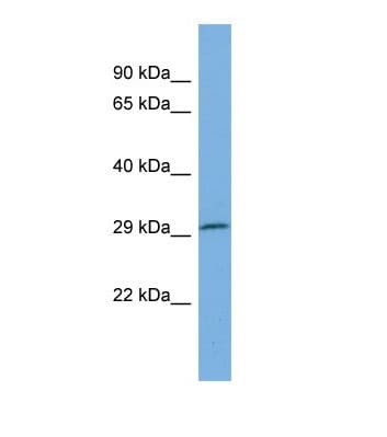 Polyclonal Rabbit anti-Human PSMB8 / LMP7 Antibody (N-Terminus, WB)