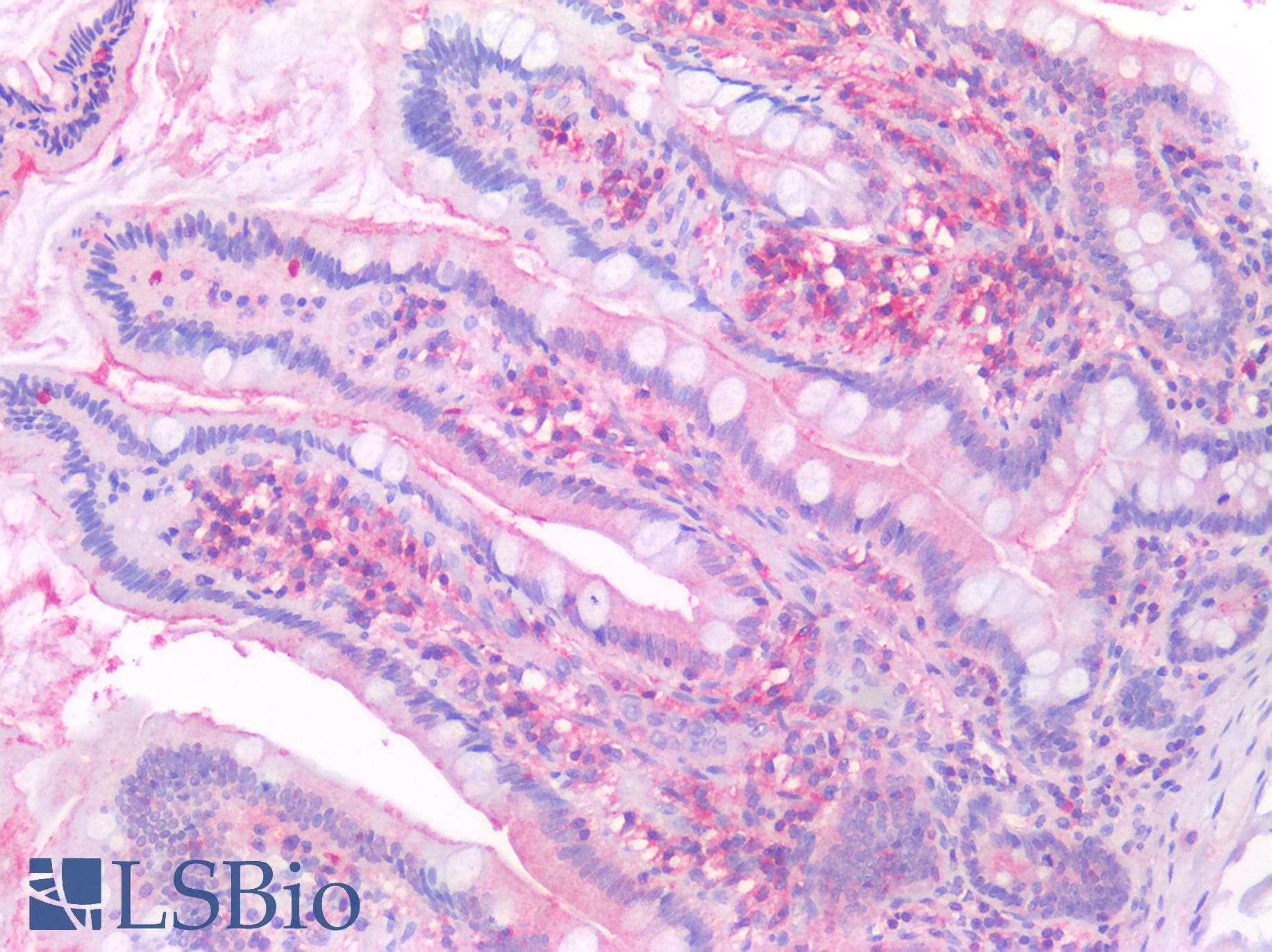 IHC-plus™ DPP4 / CD26 Antibody (Internal)