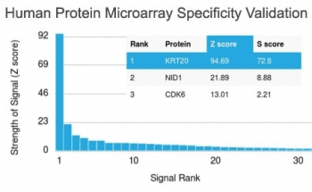KRT20 / CK20 / Cytokeratin 20 Antibody (clone KRT20/1992, Azide-free, BSA-free)