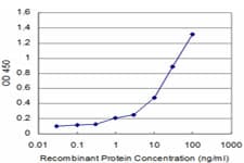Monoclonal Mouse anti-Human CALCA Antibody (clone 4B10, WB)