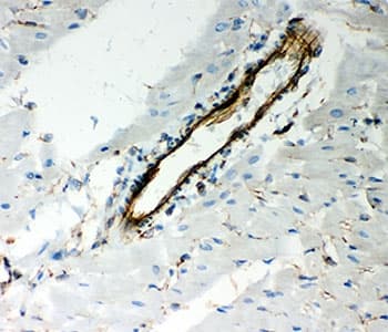 Vimentin Antibody (aa435-465)
