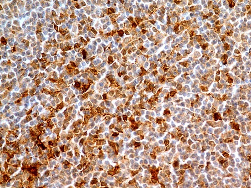 CASP8 / Caspase 8 Antibody