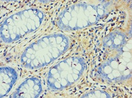ATP5F1 Antibody (aa1-245)