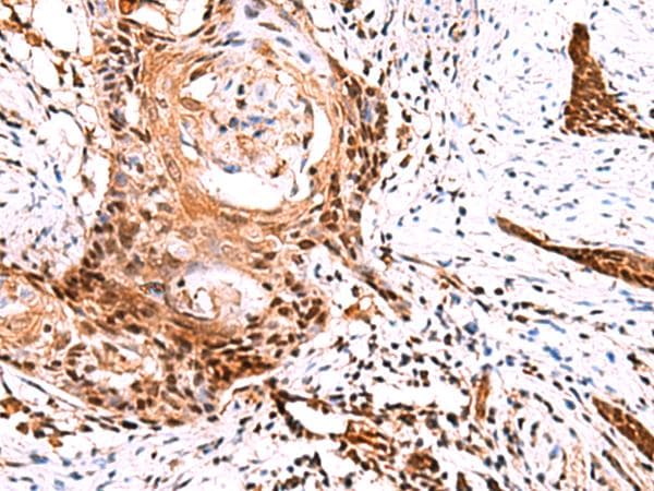 TSEN2 Antibody