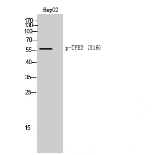 Polyclonal Rabbit anti-Human TPH2 Antibody (1-80 aa, WB)