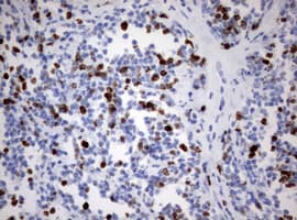 MKI67 / Ki67 Antibody (aa1160-1493, clone OTI15A4)