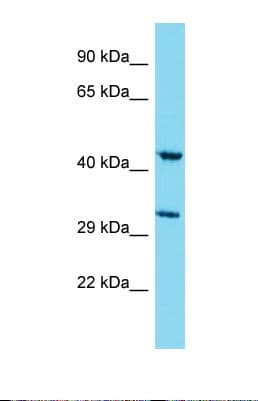 KIAA1826 Antibody (aa35-84)