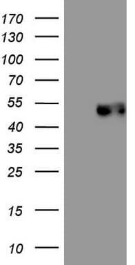 Monoclonal Mouse anti-Human PDCD1 / CD279 / PD-1 Antibody (clone OTI17F7, IF, WB)