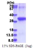 Human ANTXR2 / CMG2 Protein (Recombinant 6His, N-terminus)