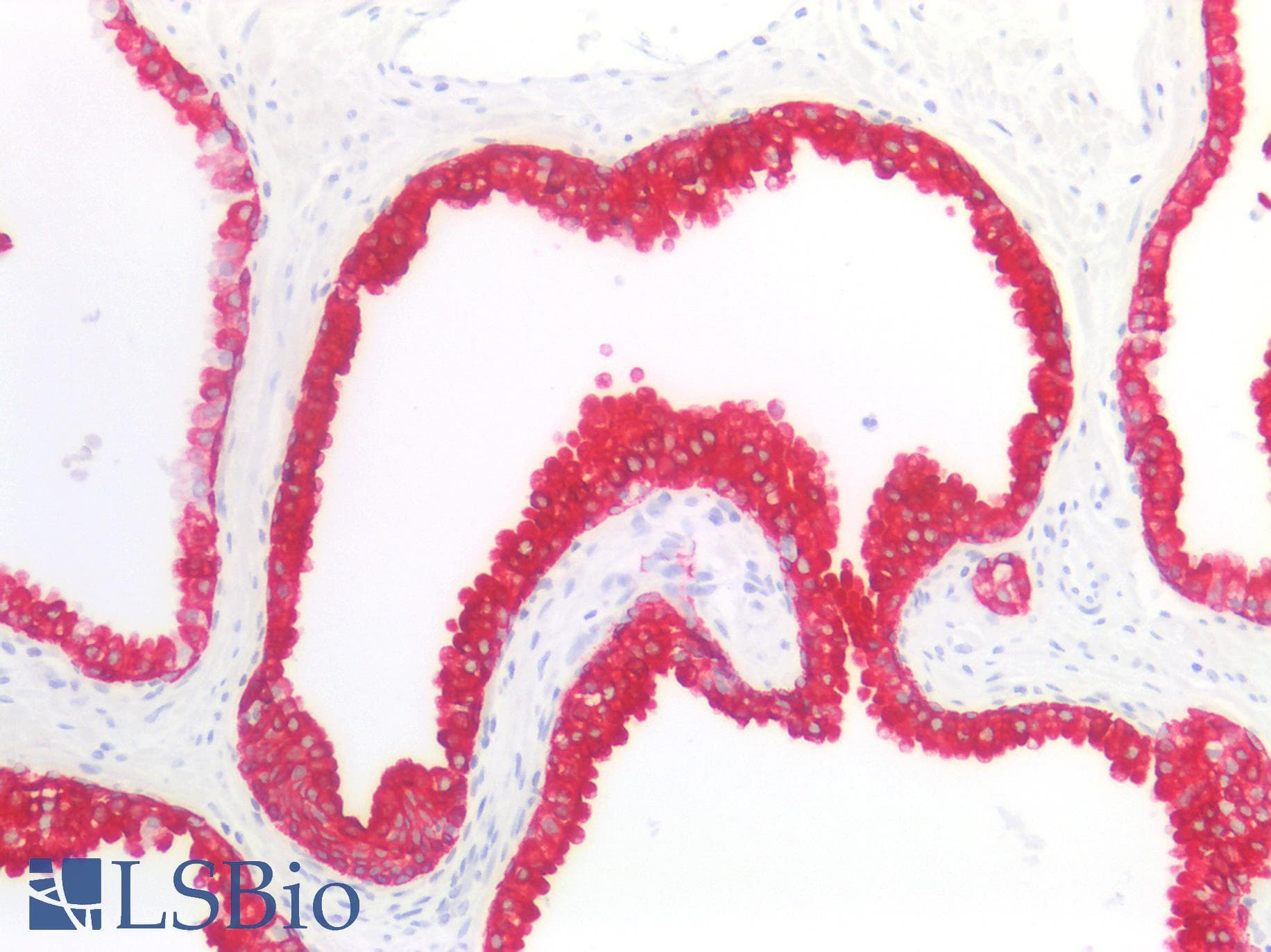 PathPlus™ Monoclonal Mouse anti-Human Acidic Cytokeratin AE1 Antibody (clone AE1, IHC)