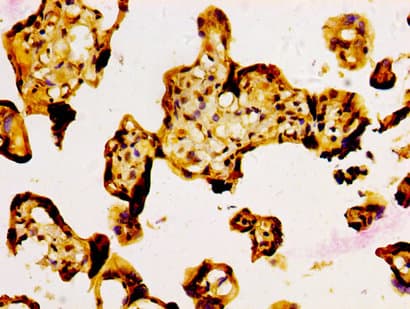 Polyclonal Rabbit anti-Human NFE2L3 Antibody (IHC, WB)