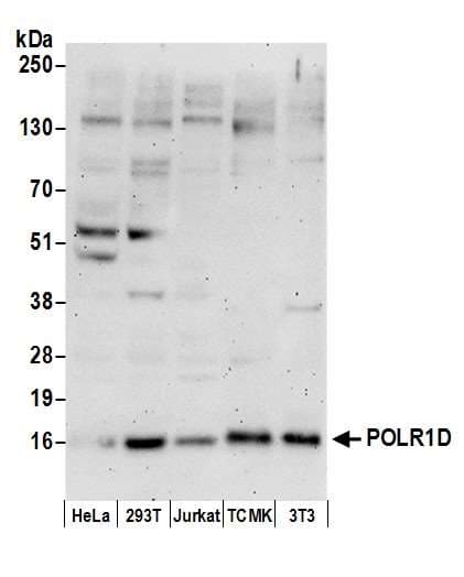 Polyclonal Rabbit anti-Human POLR1D Antibody (aa1-50, WB)