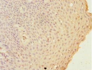 GCL / Grancalcin Antibody
