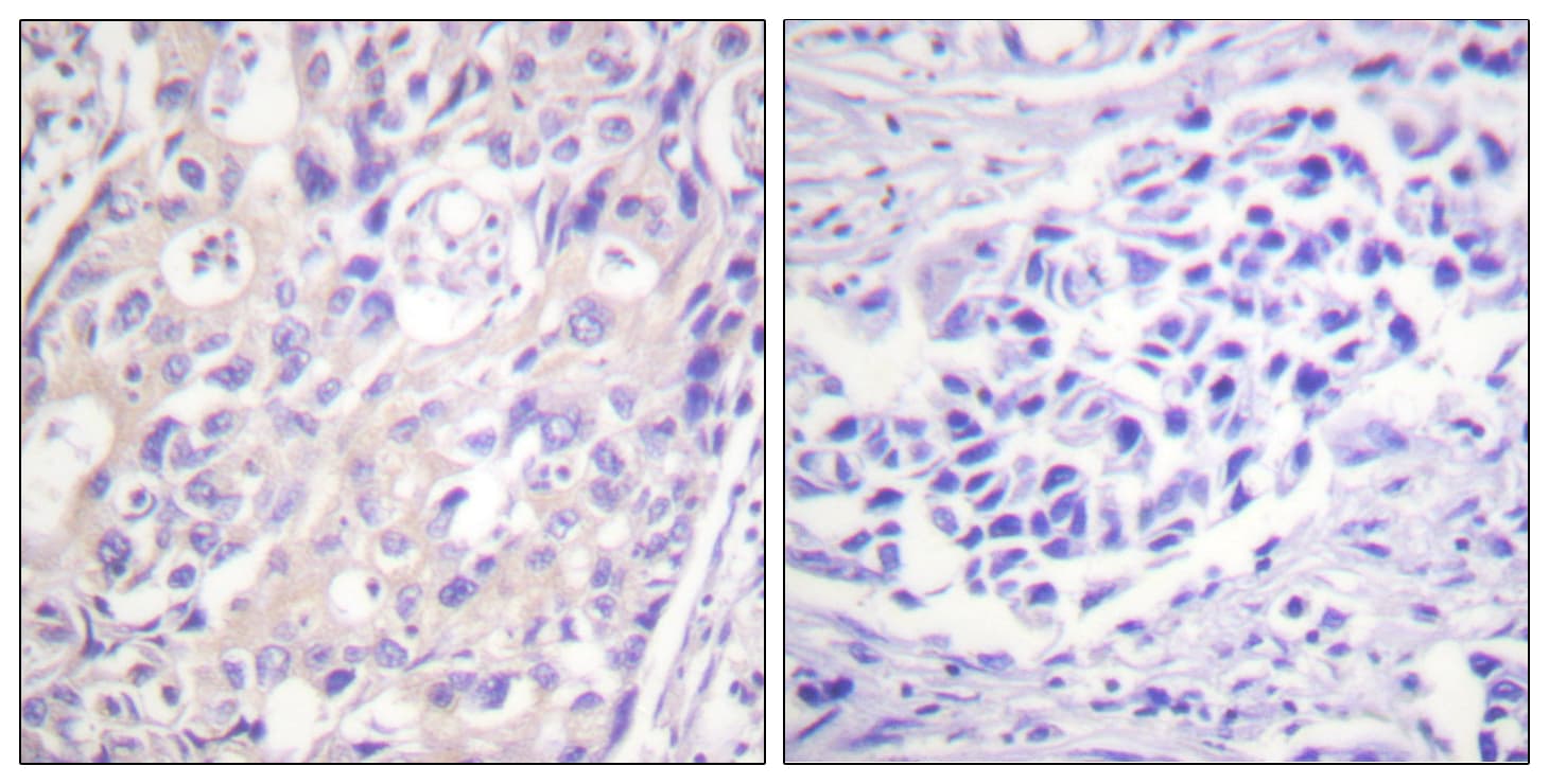 RPS6KA1 / RSK1 Antibody (phospho-Thr359/Ser363)