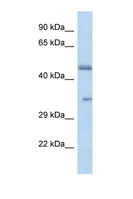 Polyclonal Rabbit anti-Human OR2L8 Antibody (C-Terminus, WB)