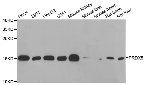 IHC-plus™ PRDX5 / Peroxiredoxin 5 Antibody