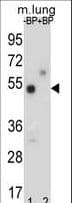 TNRC9 / TOX3 Antibody (aa214-242)