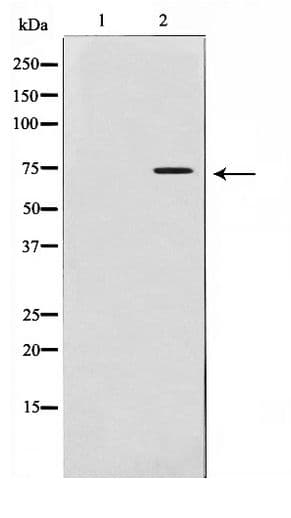 MMP2 Antibody