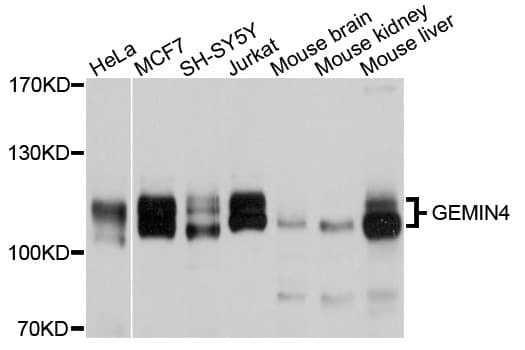 GEMIN4 Antibody