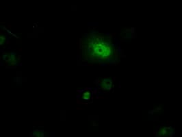 PIM2 / Pim-2 Antibody (clone OTI8G10)