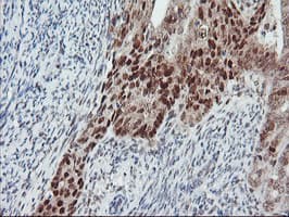 LIMK1 / LIMK Antibody (clone OTI8C8)