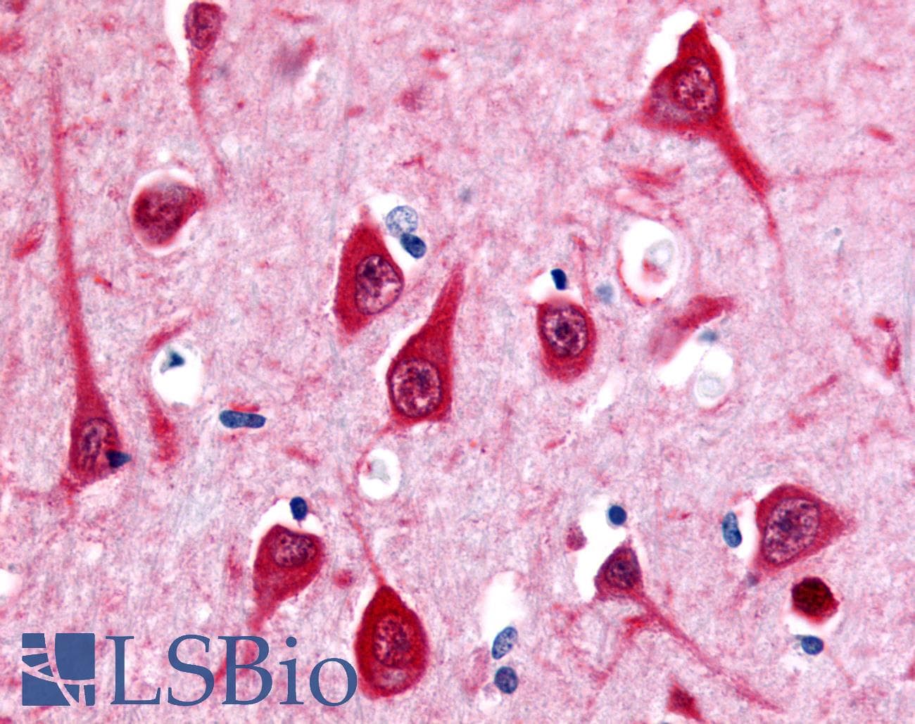 IHC-plus™ Polyclonal Rabbit anti-Human MTNR1B / MT2 Antibody (C-Terminus, IHC)